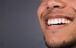 a man smiling showing his perfect teeth
